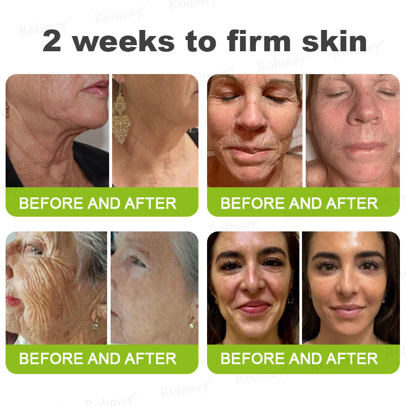 🍀👨‍⚕️Made and shipped from Australia 💫Rolimey® Botox & Vita-A Retinol Shot Wrinkle-Lift Tightening cream - Last Day Promotion 70% OFF Upsell