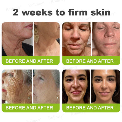 🍀👨‍⚕️Made and shipped from Australia 💫Rolimey® Botox & Vita-A Retinol Shot Wrinkle-Lift Tightening cream - Last Day Promotion 70% OFF Upsell