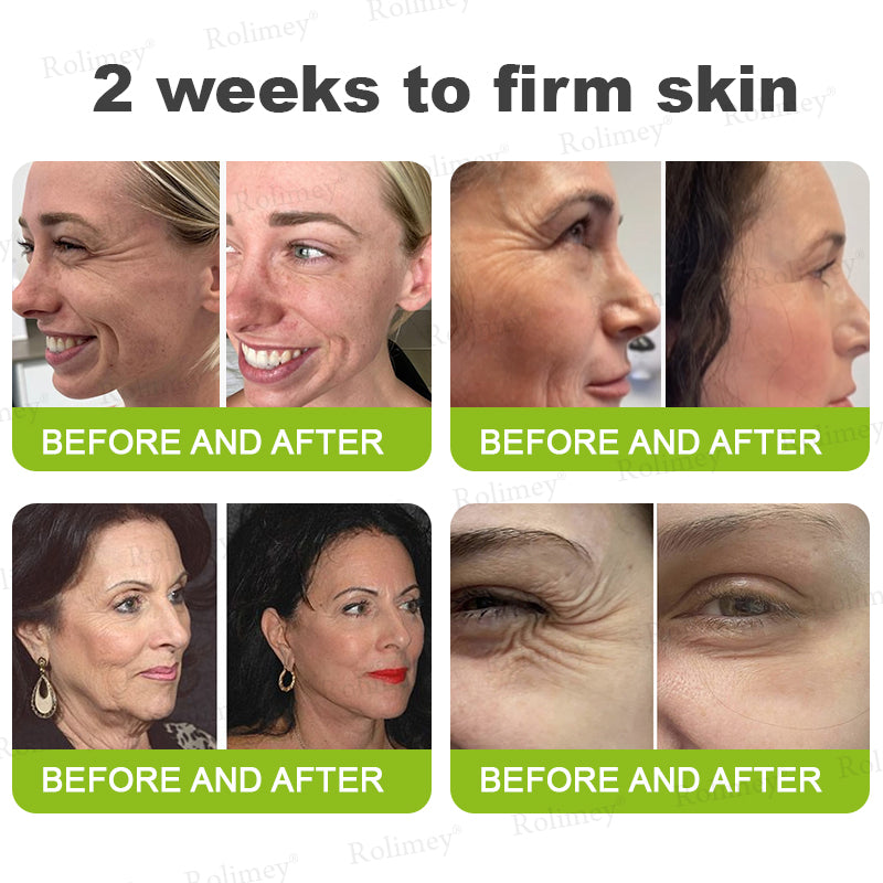 🍀👨‍⚕️Made and shipped from Australia 💫Rolimey® Botox & Vita-A Retinol Shot Wrinkle-Lift Tightening cream - Last Day Promotion 70% OFF Upsell