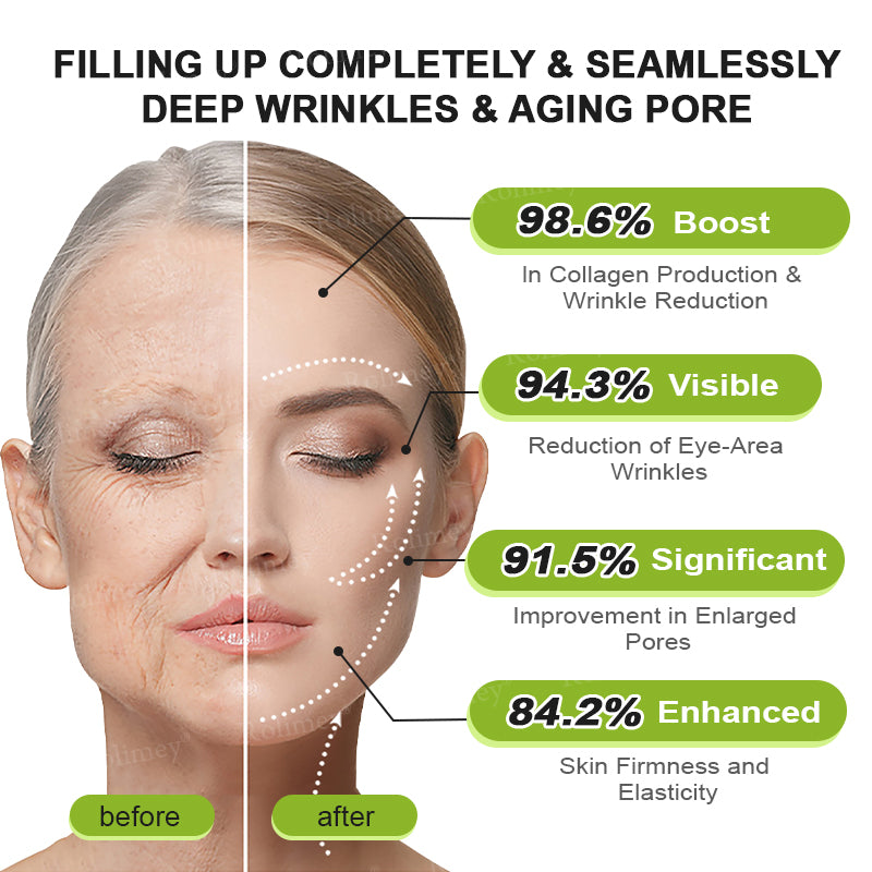 🍀👨‍⚕️Made and shipped from Australia 💫Rolimey® Botox & Vita-A Retinol Shot Wrinkle-Lift Tightening cream - Last Day Promotion 70% OFF Upsell