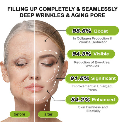 🍀👨‍⚕️Made and shipped from Australia 💫Rolimey® Botox & Vita-A Retinol Shot Wrinkle-Lift Tightening cream - Last Day Promotion 70% OFF Upsell