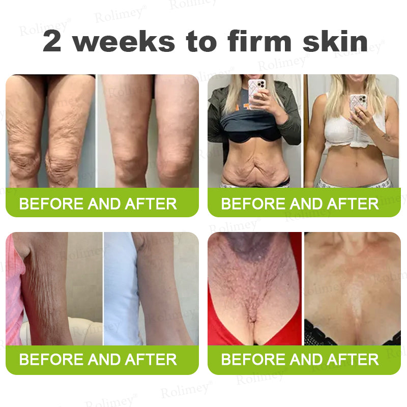 🍀👨‍⚕️Made and shipped from Australia 💫Rolimey® Botox & Vita-A Retinol Shot Wrinkle-Lift Tightening cream - Last Day Promotion 70% OFF Upsell