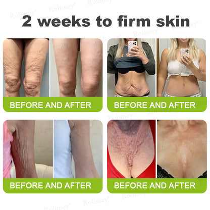 🍀👨‍⚕️Made and shipped from Australia 💫Rolimey® Botox & Vita-A Retinol Shot Wrinkle-Lift Tightening cream - Last Day Promotion 70% OFF Upsell