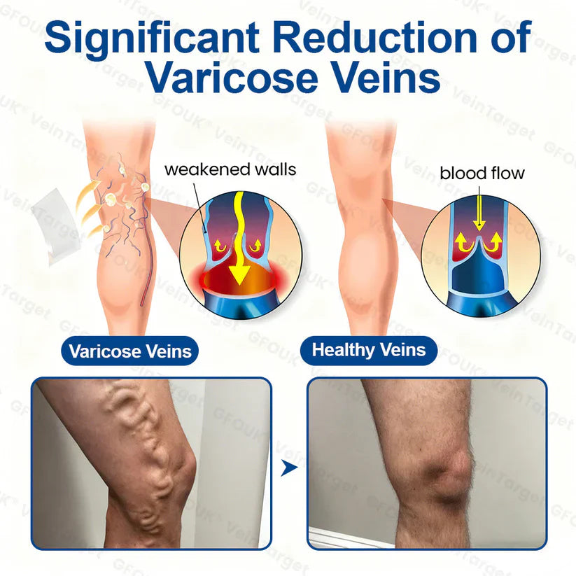 💟💟GFOUK® VeinTarget Microneedle Patch⚡Instant Relief, Long-Term Results